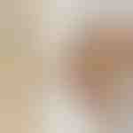 Set prstenova | SPARKLET